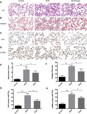 Gypenosides Attenuate Pulmonary Fibrosis by Inhibiting the AKT/mTOR/c-Myc Pathway